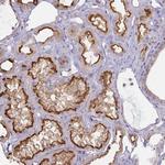 ANKRD33 Polyclonal Antibody