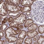 PPM1H Antibody in Immunohistochemistry (Paraffin) (IHC (P))