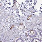 UBL3 Polyclonal Antibody