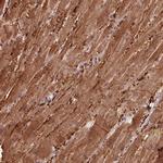 CCDC168 Polyclonal Antibody