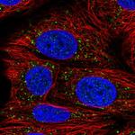 AACS Polyclonal Antibody