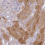 ANO5 Polyclonal Antibody