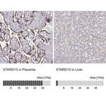 STARD13 Polyclonal Antibody