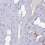 OR1L3 Antibody in Immunohistochemistry (Paraffin) (IHC (P))