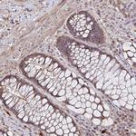 ZNF805 Polyclonal Antibody