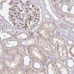 PALM2-AKAP2 Antibody in Immunohistochemistry (Paraffin) (IHC (P))