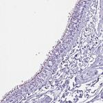 MRGPRG Polyclonal Antibody