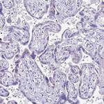 SAMD13 Antibody in Immunohistochemistry (Paraffin) (IHC (P))