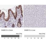 SAMD13 Antibody in Immunohistochemistry (IHC)