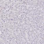 SAMD13 Antibody in Immunohistochemistry (IHC)