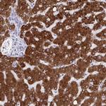 CYP4F2 Polyclonal Antibody