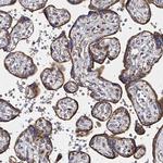 ATAD3B Antibody in Immunohistochemistry (Paraffin) (IHC (P))