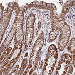 ATAD3B Antibody in Immunohistochemistry (Paraffin) (IHC (P))