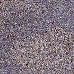 ATAD3B Antibody in Immunohistochemistry (Paraffin) (IHC (P))