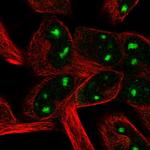 LHFP Polyclonal Antibody