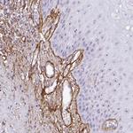 LHFP Antibody in Immunohistochemistry (Paraffin) (IHC (P))