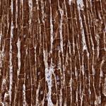 MP68 Antibody in Immunohistochemistry (IHC)