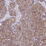 MP68 Antibody in Immunohistochemistry (IHC)