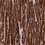 MP68 Antibody in Immunohistochemistry (IHC)