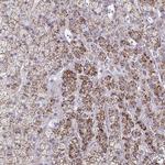 LRRC4B Polyclonal Antibody