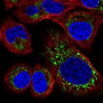 HRASLS2 Polyclonal Antibody