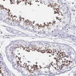 HRASLS2 Antibody in Immunohistochemistry (Paraffin) (IHC (P))