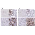 PITPNM3 Polyclonal Antibody