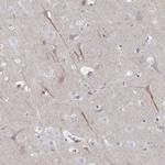 CEP170B Antibody in Immunohistochemistry (IHC)