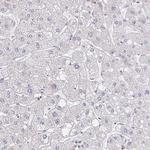CEP170B Antibody in Immunohistochemistry (IHC)