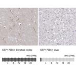 CEP170B Antibody