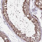 PIGY Polyclonal Antibody