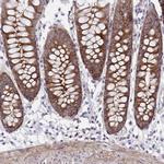 PPIH Polyclonal Antibody