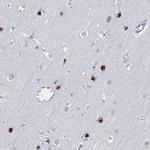 XAGE3 Antibody in Immunohistochemistry (Paraffin) (IHC (P))