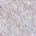 HHLA1 Antibody in Immunohistochemistry (IHC)