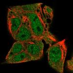 TM41A Polyclonal Antibody