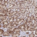TM41A Antibody in Immunohistochemistry (IHC)