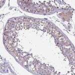 TCEAL8 Antibody in Immunohistochemistry (IHC)