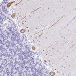 SEL1L2 Polyclonal Antibody