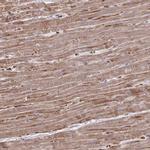 FUNDC2 Antibody in Immunohistochemistry (Paraffin) (IHC (P))