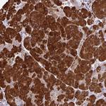 FUNDC2 Antibody in Immunohistochemistry (Paraffin) (IHC (P))