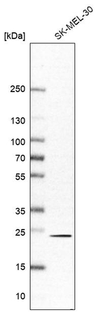 RAB6A Antibody in Western Blot (WB)
