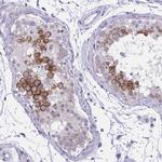 NFXL1 Antibody in Immunohistochemistry (Paraffin) (IHC (P))