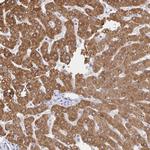 ZNF100 Polyclonal Antibody