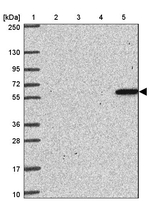 ZNF100 Antibody in Western Blot (WB)