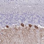 GALNT16 Antibody in Immunohistochemistry (Paraffin) (IHC (P))