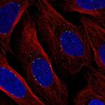 DPY19L1 Polyclonal Antibody