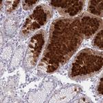 DPY19L1 Antibody in Immunohistochemistry (Paraffin) (IHC (P))