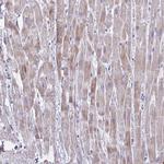 BCL6B Polyclonal Antibody