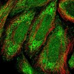 ZNF684 Antibody in Immunocytochemistry (ICC/IF)
