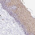 ZNF684 Antibody in Immunohistochemistry (Paraffin) (IHC (P))